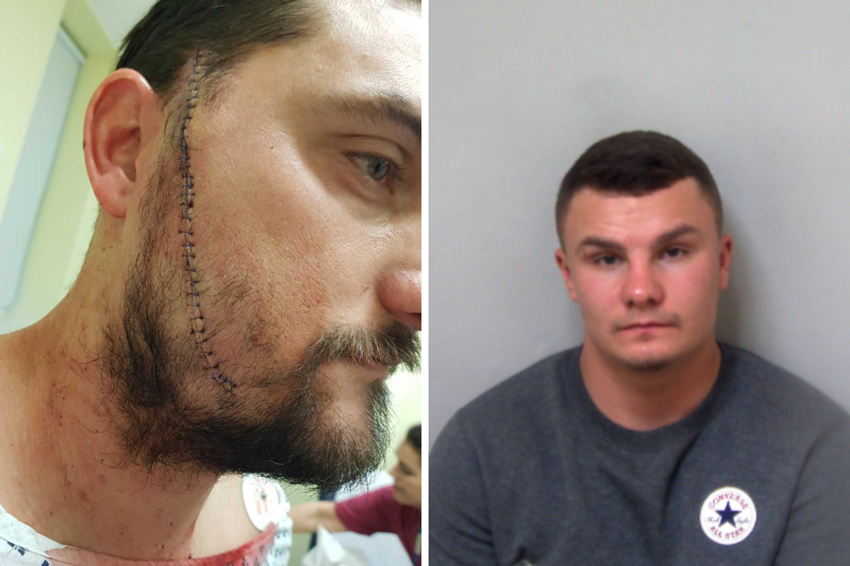 Clacton victim says 'no sentence enough' after belt assault | Clacton and Frinton Gazette - Vimarsana News