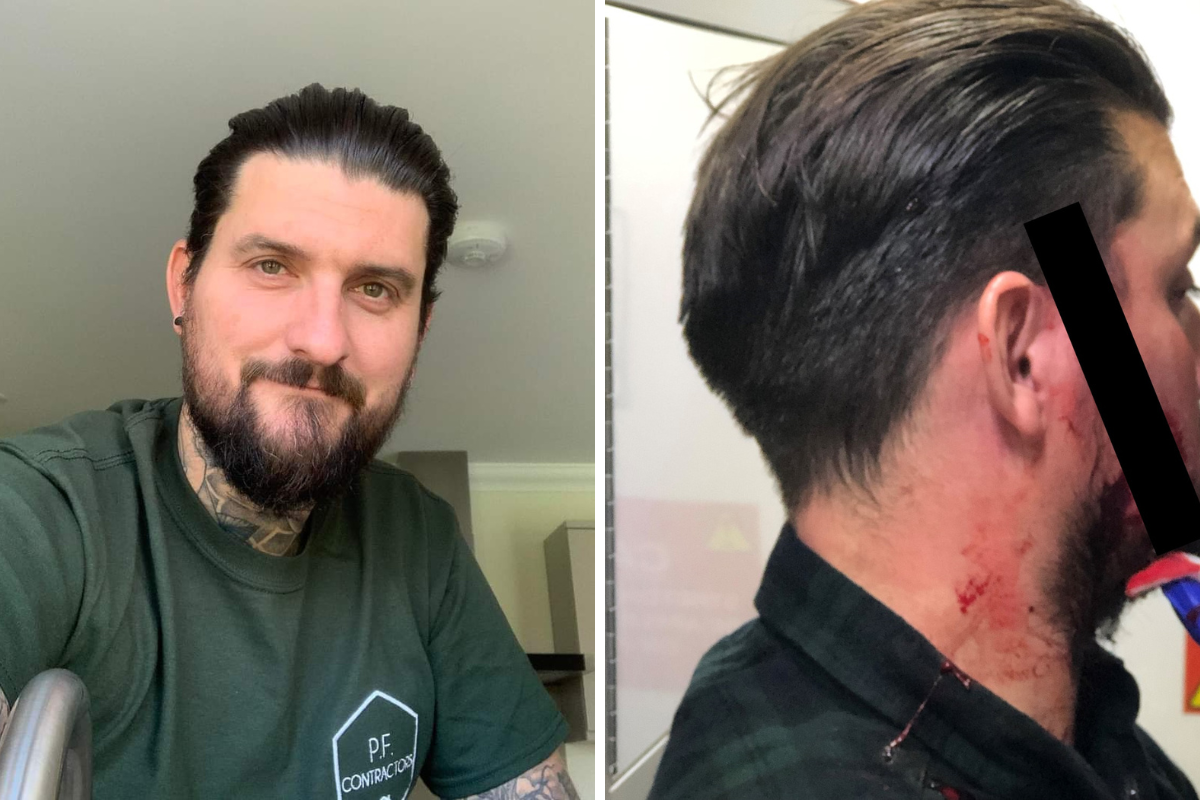 Family speak out on Clacton bar attack which saw man jailed | Clacton and Frinton Gazette - Vimarsana News